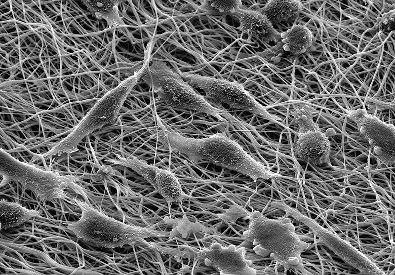 Scanning electron microscopy image of mouse fibroblasts